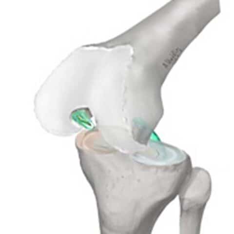 Ligament Crois Post Rieur Cot Est Paris