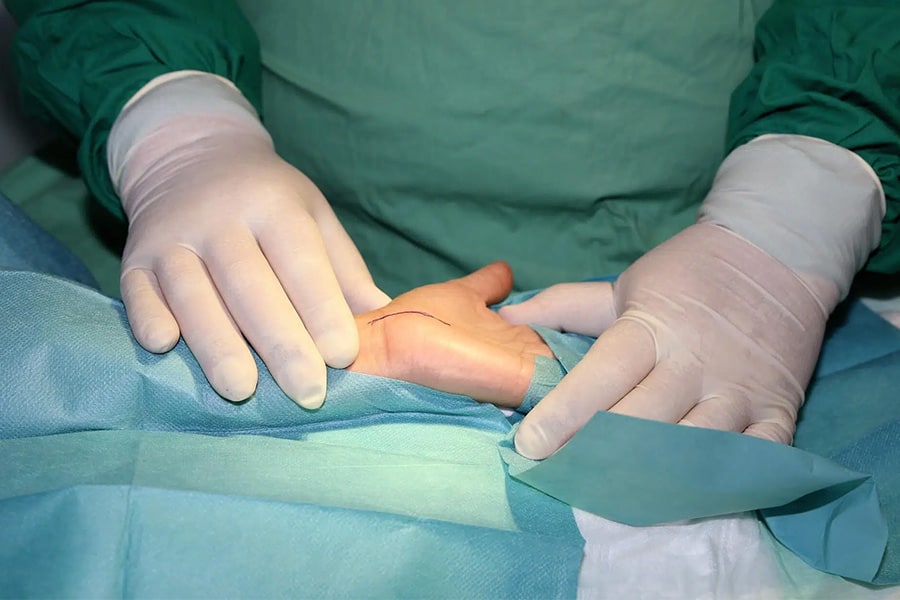 operation du canal carpien clinique orthopedique cot est dr vanessa costil laurent thomsen chirurgiens orthopedistes specialistes chirurgie de la main paris grand est.jpg