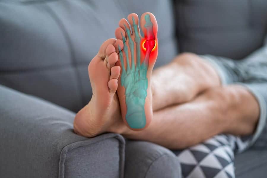 Hallux valgus : qui consulter pour un traitement ?